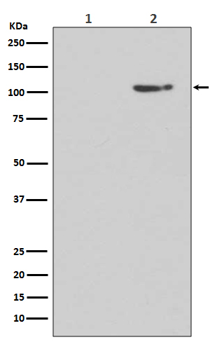 1 - Anti-Phospho-GluR1 (S845) GRIA1 Rabbit Monoclonal Antibody ABO13096