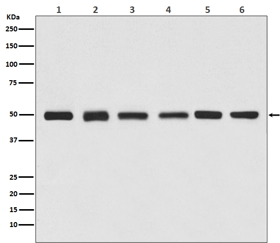 1 - Anti-beta Tubulin Rabbit Monoclonal Antibody, HRP Conjugated ABO13101