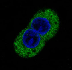 3 - Anti-Phospho-Tyrosine Rabbit Monoclonal Antibody ABO13103