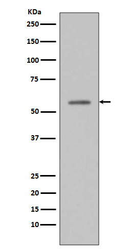 1 - Anti-Phospho-p53 (S33) TP53 Rabbit Monoclonal Antibody ABO13104