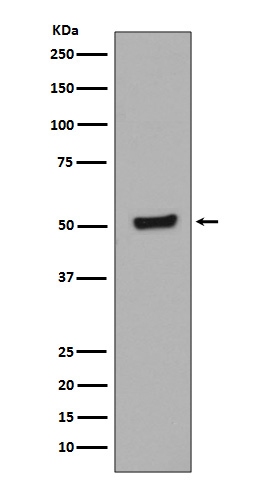1 - Anti-Phospho-p53 (T55) TP53 Rabbit Monoclonal Antibody ABO13105