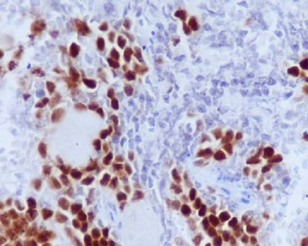2 - Anti-Phospho-Rb (S807) RB1 Rabbit Monoclonal Antibody ABO13106
