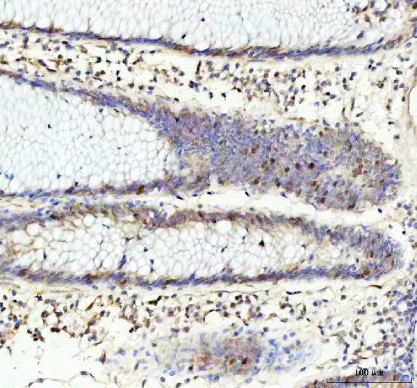 2 - Anti-Phospho-Rb (S807) RB1 Rabbit Monoclonal Antibody ABO13106