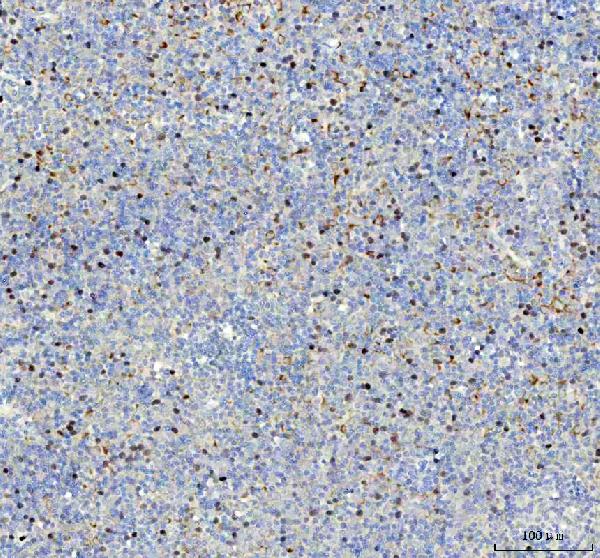 2 - Anti-Phospho-Rb (S807) RB1 Rabbit Monoclonal Antibody ABO13106