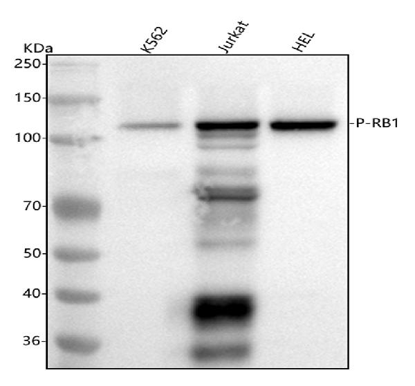 1 - Anti-Phospho-Rb (S807) RB1 Rabbit Monoclonal Antibody ABO13106