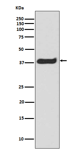 1 - Anti-Phospho-LAT (Y191) Rabbit Monoclonal Antibody ABO13107