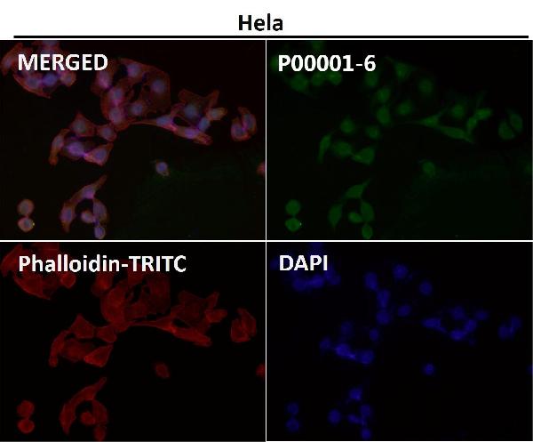 1 - Anti-Phospho-p53 (S392) TP53 Rabbit Monoclonal Antibody ABO13108