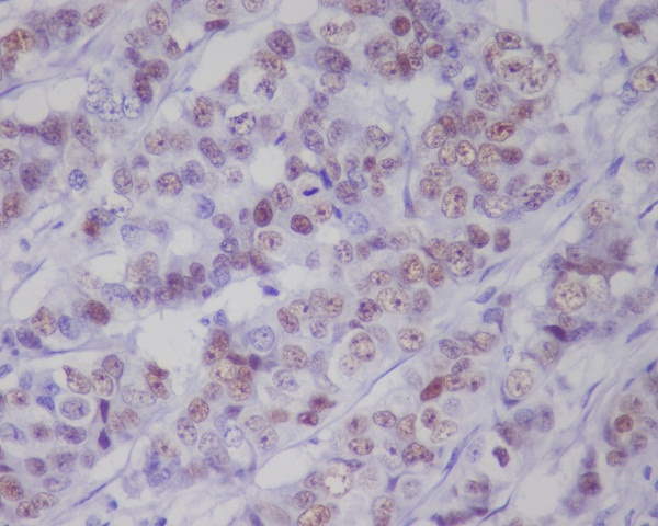 2 - Anti-Phospho-p53 (S392) TP53 Rabbit Monoclonal Antibody ABO13108
