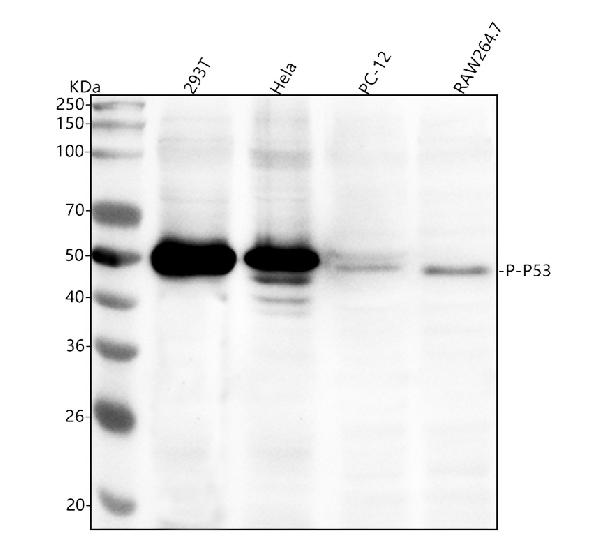 1 - Anti-Phospho-p53 (S392) TP53 Rabbit Monoclonal Antibody ABO13108