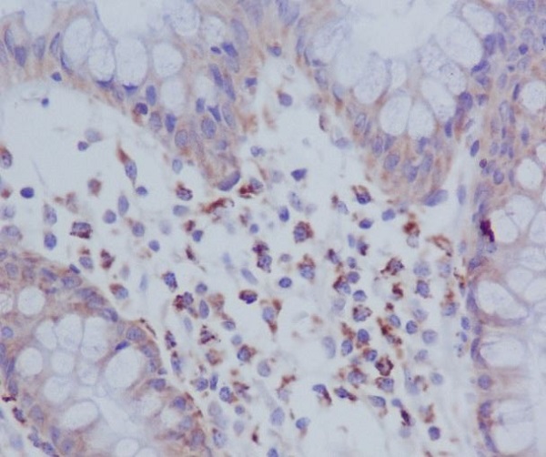 2 - Anti-Phospho-PKR (T446) EIF2AK2 Rabbit Monoclonal Antibody ABO13109