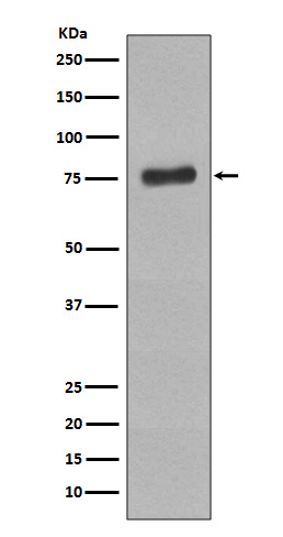 1 - Anti-Phospho-BTK (Y223) Rabbit Monoclonal Antibody ABO13111