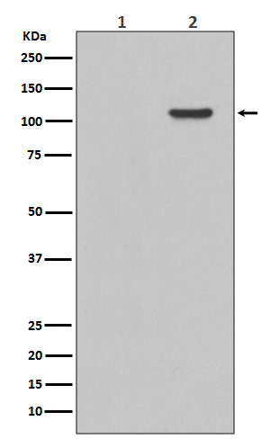 1 - Anti-Phospho-FAK (Y397) PTK2 Rabbit Monoclonal Antibody ABO13112