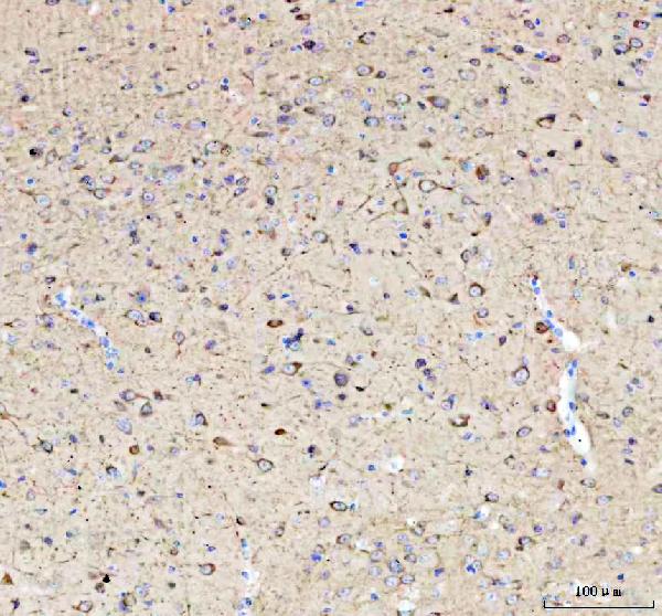 2 - Anti-Phospho-Tau (T231) MAPT Rabbit Monoclonal Antibody ABO13113
