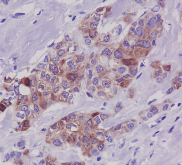 2 - Anti-Phospho-Tau (S396) MAPT Rabbit Monoclonal Antibody ABO13115