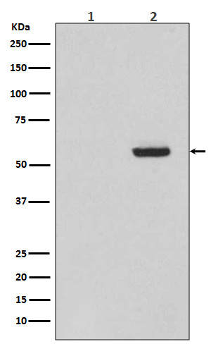 1 - Anti-Phospho-Tau (S396) MAPT Rabbit Monoclonal Antibody ABO13115