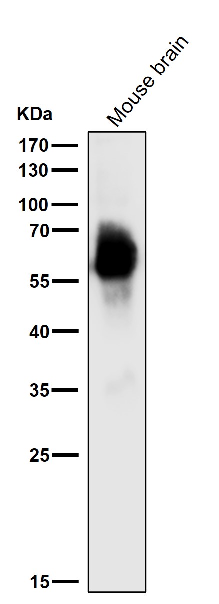 1 - Anti-Phospho-Tau (S396) MAPT Rabbit Monoclonal Antibody ABO13115