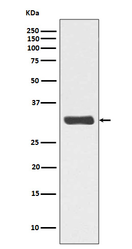 1 - Anti-Phospho-RPA2 (T21) Rabbit Monoclonal Antibody ABO13116