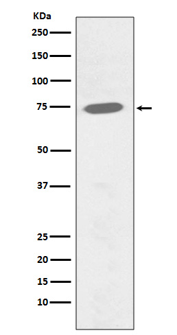 1 - Anti-Phospho-BTK (Y551) Rabbit Monoclonal Antibody ABO13118