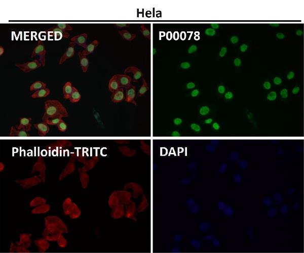 1 - Anti-Phospho-Nrf2 (S40) NFE2L2 Rabbit Monoclonal Antibody ABO13121