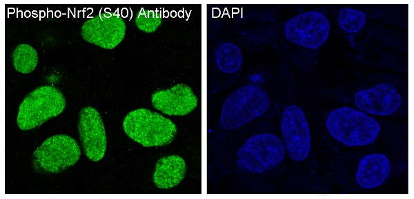 3 - Anti-Phospho-Nrf2 (S40) NFE2L2 Rabbit Monoclonal Antibody ABO13121