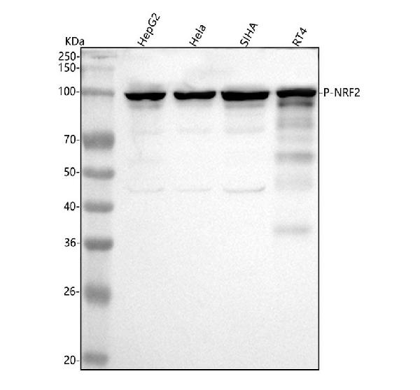 1 - Anti-Phospho-Nrf2 (S40) NFE2L2 Rabbit Monoclonal Antibody ABO13121