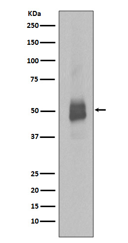 1 - Anti-Phospho-Lyn (Y396) Rabbit Monoclonal Antibody ABO13122
