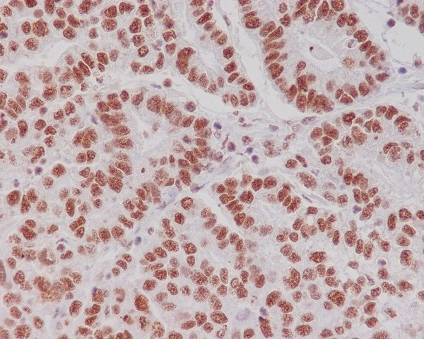 2 - Anti-Phospho-Creb (S133) CREB1 Rabbit Monoclonal Antibody ABO13123