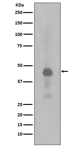 1 - Anti-Phospho-Creb (S133) CREB1 Rabbit Monoclonal Antibody ABO13123