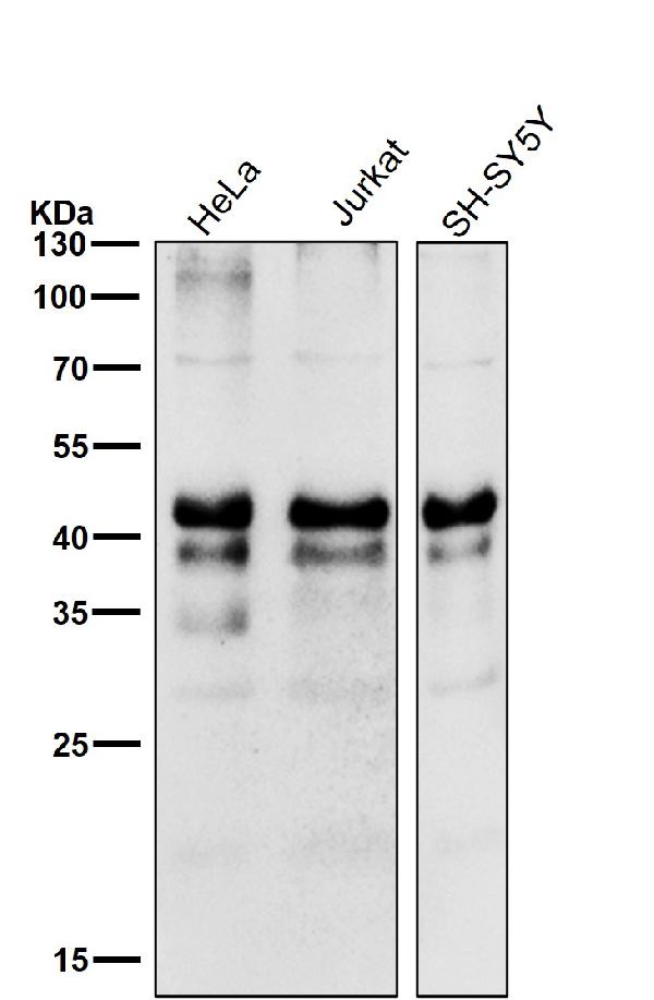 1 - Anti-Phospho-Creb (S133) CREB1 Rabbit Monoclonal Antibody ABO13123