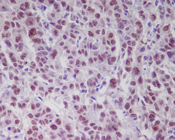 2 - Anti-Phospho-ATM (S1981) Rabbit Monoclonal Antibody ABO13125