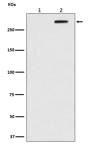 1 - Anti-Phospho-ATM (S1981) Rabbit Monoclonal Antibody ABO13125