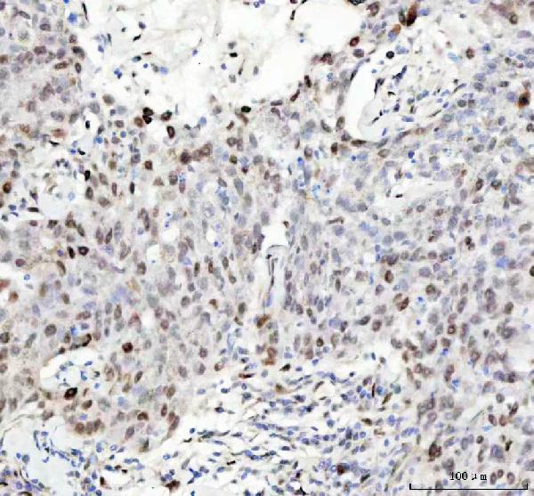 2 - Anti-Phospho-HSF1 (S326) Rabbit Monoclonal Antibody ABO13126