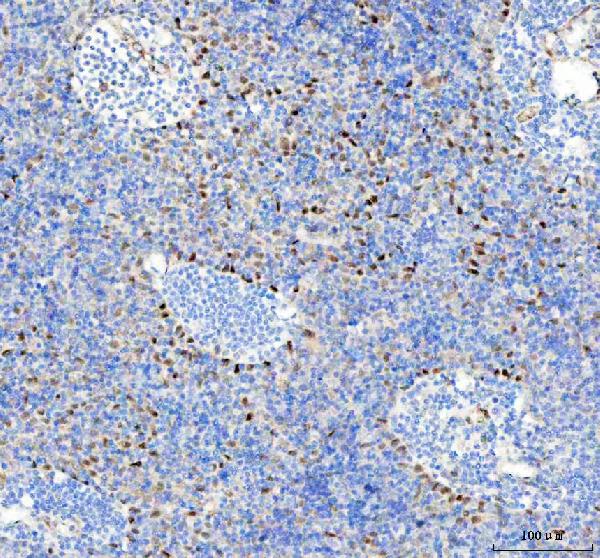 2 - Anti-Phospho-HSF1 (S326) Rabbit Monoclonal Antibody ABO13126