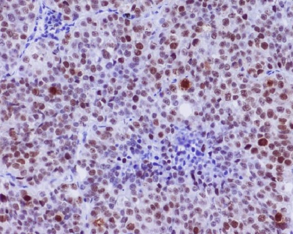 2 - Anti-Phospho-c-Myc (S62) Rabbit Monoclonal Antibody ABO13127