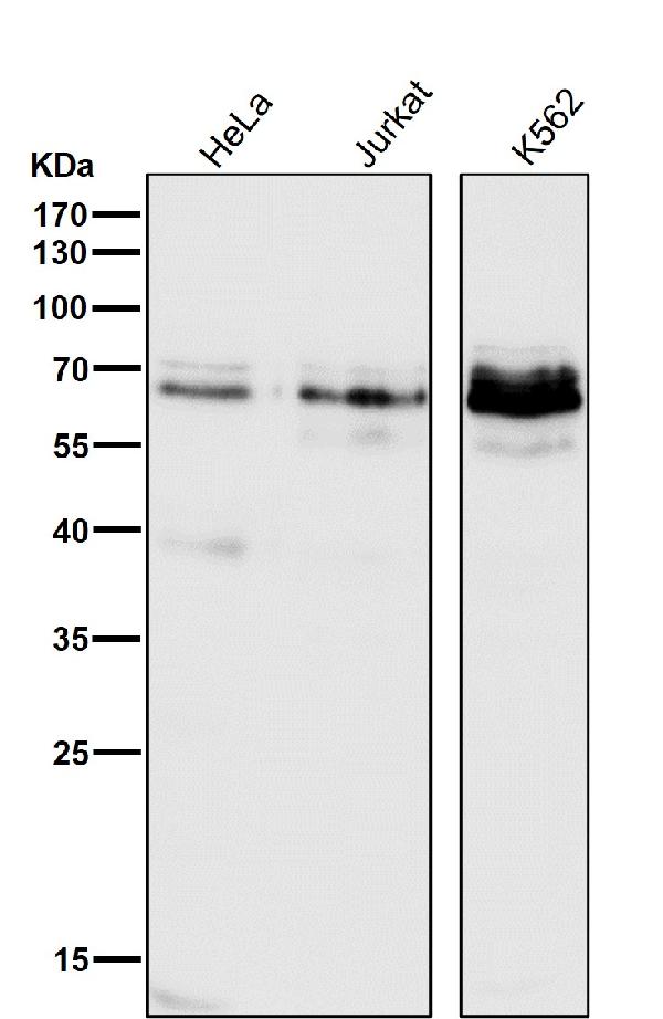 1 - Anti-Phospho-c-Myc (S62) Rabbit Monoclonal Antibody ABO13127