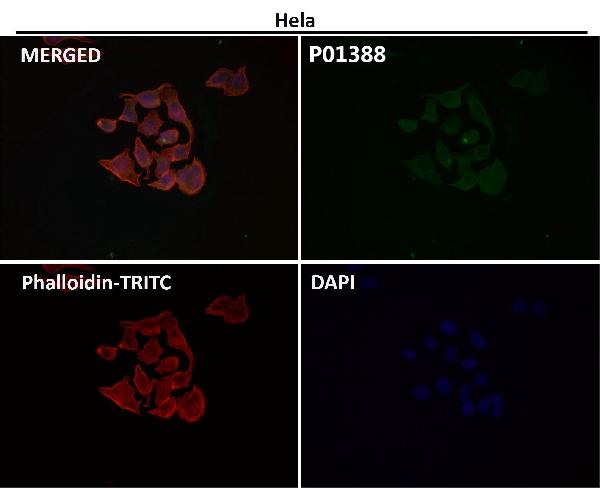 1 - Anti-Phospho-TrkB (Y817) NTRK2 Rabbit Monoclonal Antibody ABO13129