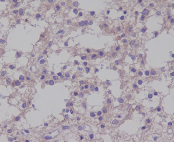 2 - Anti-Phospho-TrkB (Y817) NTRK2 Rabbit Monoclonal Antibody ABO13129
