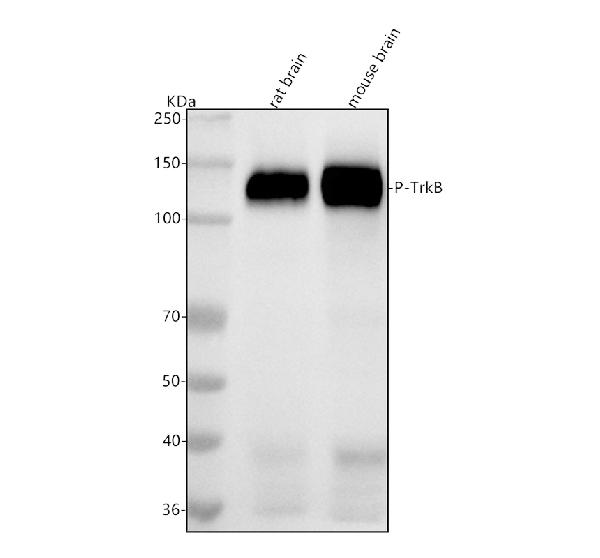 1 - Anti-Phospho-TrkB (Y817) NTRK2 Rabbit Monoclonal Antibody ABO13129