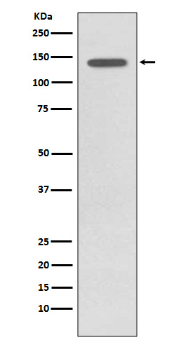 1 - Anti-Phospho-TrkB (Y817) NTRK2 Rabbit Monoclonal Antibody ABO13129