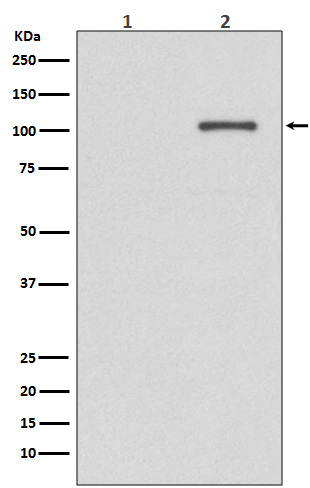 1 - Anti-Phospho-IRE1 (S724) ERN1 Rabbit Monoclonal Antibody ABO13130