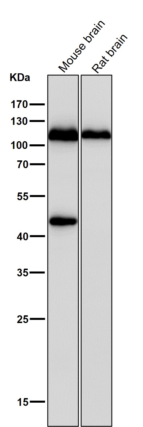 1 - Anti-Phospho-IRE1 (S724) ERN1 Rabbit Monoclonal Antibody ABO13130