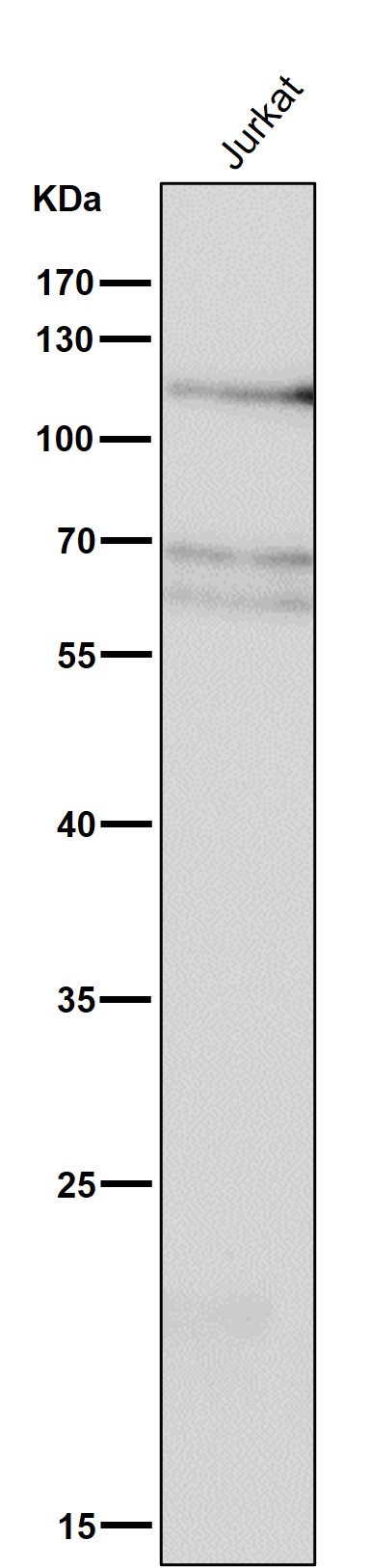 1 - Anti-Phospho-IRE1 (S724) ERN1 Rabbit Monoclonal Antibody ABO13130