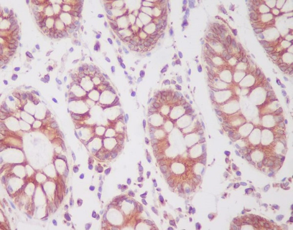 2 - Anti-Phospho-SIRT1 (S47) Rabbit Monoclonal Antibody ABO13133