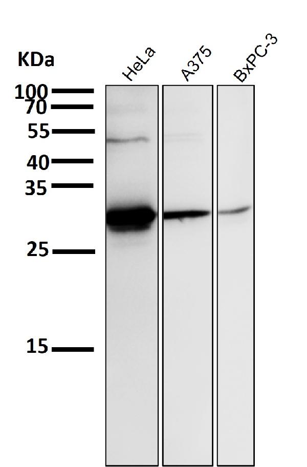 1 - Anti-Phospho-Hsp27 (S82) HSPB1 Rabbit Monoclonal Antibody ABO13135