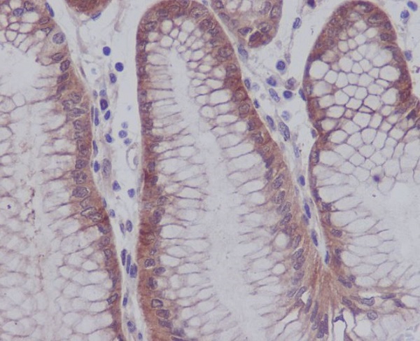 2 - Anti-Phospho-YAP1 (S127) Rabbit Monoclonal Antibody ABO13136