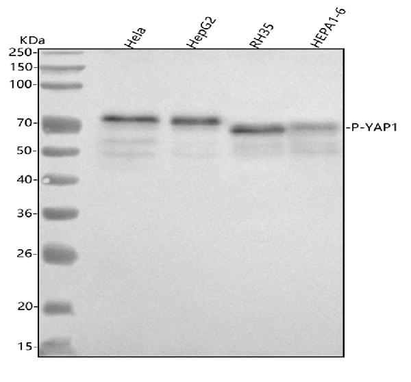 1 - Anti-Phospho-YAP1 (S127) Rabbit Monoclonal Antibody ABO13136
