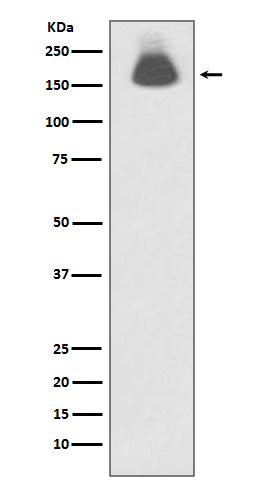 1 - Anti-Phospho-EGFR (S695) Rabbit Monoclonal Antibody ABO13137
