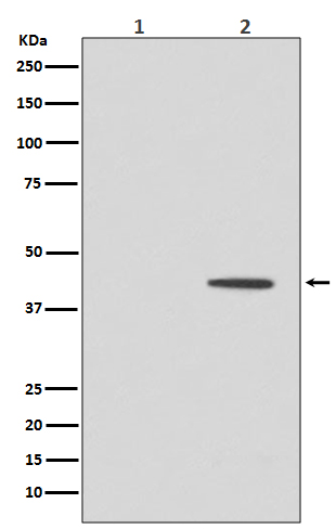 1 - Anti-Phospho-MEK1 (T292) MAP2K1 Rabbit Monoclonal Antibody ABO13141