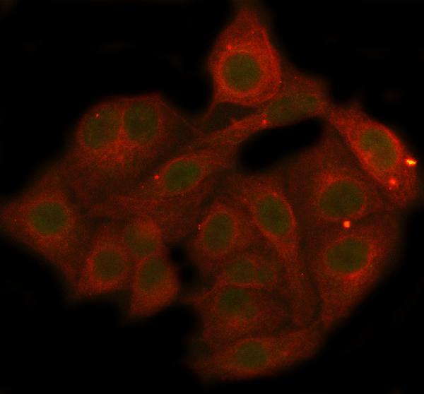 3 - Anti-Phospho-AKT1 (T450) Rabbit Monoclonal Antibody ABO13143