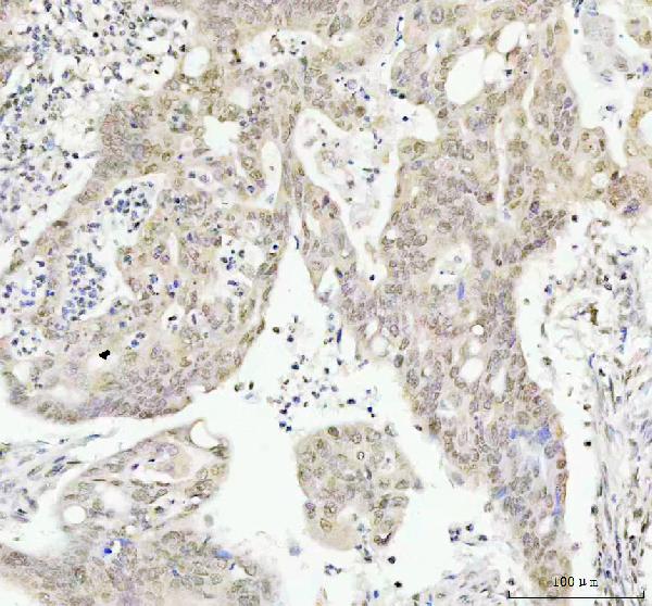 2 - Anti-Phospho-AKT1 (T450) Rabbit Monoclonal Antibody ABO13143